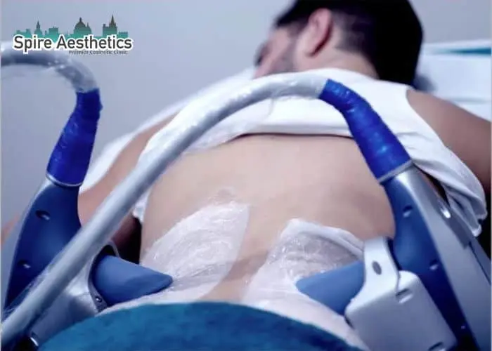 Man having fat freezing treatment done on love handles before a competitions Newlands to create a sculpted look.